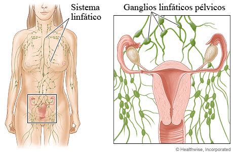 Ganglios Linf Ticos P Lvicos Cigna