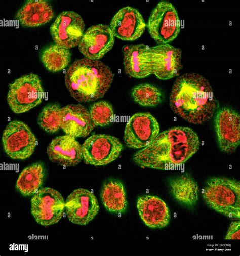 Mitosis Confocal Light Micrograph Of Hela Cells During Mitosis