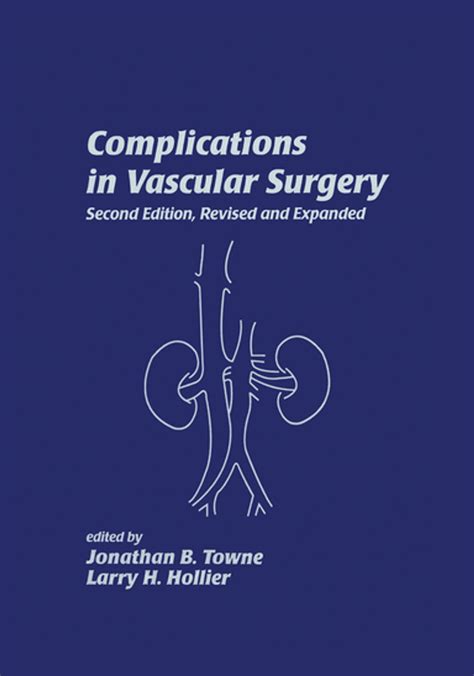 Complications in Vascular Surgery eBook by - EPUB Book | Rakuten Kobo United States