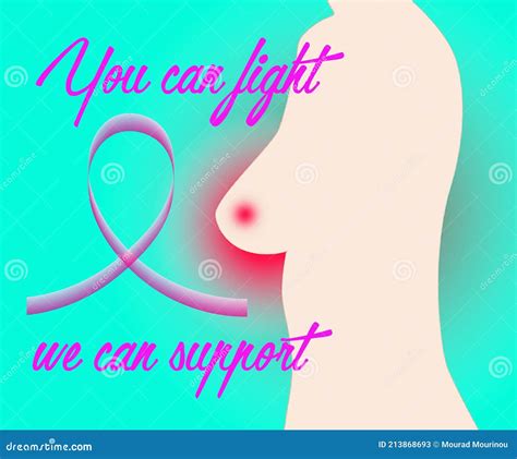 Illustration Of A Breast Cancer Stock Illustration Illustration Of Concept Ruban 213868693