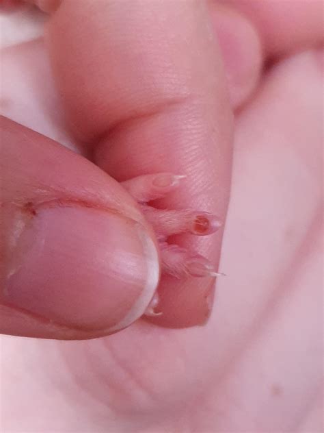 Found when trimming nails, feels like a scab, ingrown nail or something
