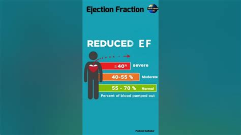 Ejection Fractionejection Fractionnormal Ef Value Heart Problem