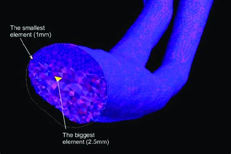 The Three Dimensional Reconstruction Of A Stent Graft A With An