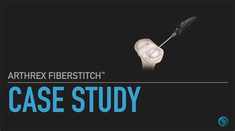 Arthrex Fiberstitch Meniscal Repair Case Study Youtube