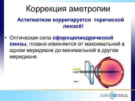 Что представляют собой астигматические линзы?