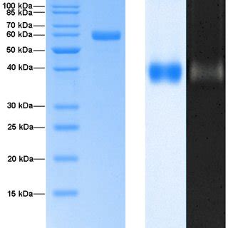 Sds Page And Native Page Analysis Of The Purified Amylolytic Enzyme