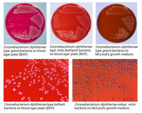 Corynebacterium Diphtheriae Colony Morphology