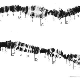 The Polytene Chromosomes Set Of P Uti Is From The Salivary Glands Of