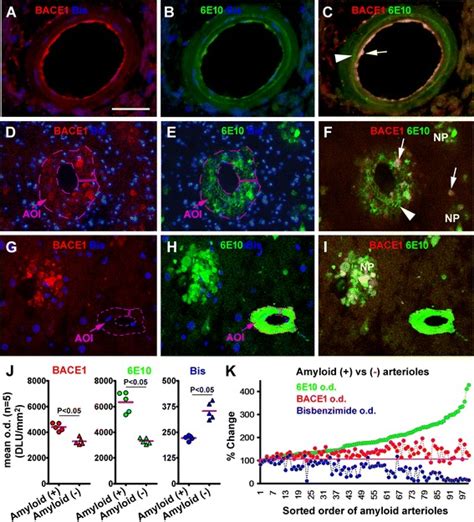 Non Neuronal And Neuronal BACE1 Elevation In Association With