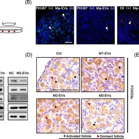 Macrophagederived Extracellular Vesicles Evs Affect Activation Of