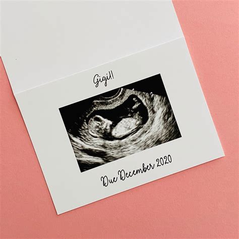 Custom Pregnancy Announcement Card Ultrasound Card Etsy