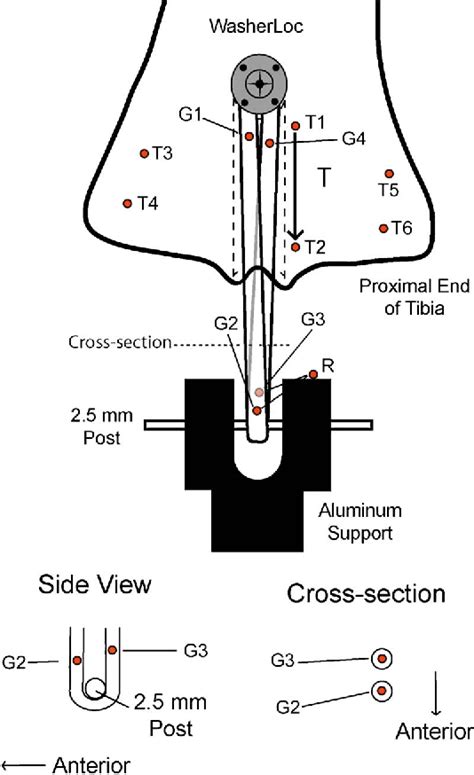 Figure From Lengthening Of A Single Loop Tibialis Tendon Graft