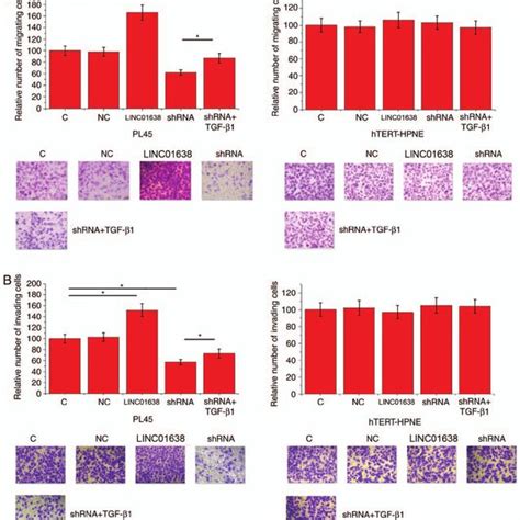 LINC01638 regulated PDAC cell migration and invasion through TGF β1