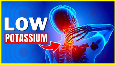 7 Signs You Have A Potassium Deficiency Youtube