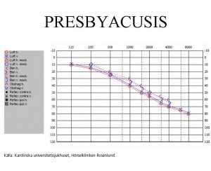 Audiogram vid presbyacusis - Doktorerna.com