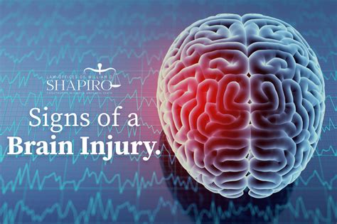 Common Signs Of A Brain Injury Causes And Cures William D Shapiro