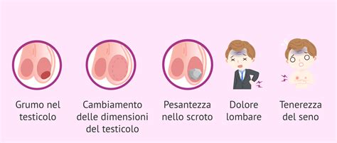 Cancro Ai Testicoli Cos Sintomi Cause E Trattamento Hot Sex Picture