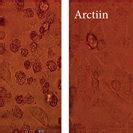 Effects Of TP Arctiin And TP Arctiin On The Morphology Of HepG2