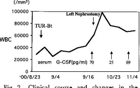 Figure From A Case Of Bladder Tumor Producing Granulocyte Colony