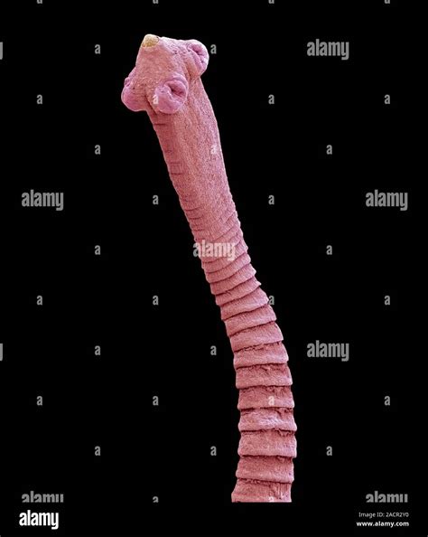 Flea Tapeworm Coloured Scanning Electron Micrograph Sem Of A Flea Tapeworm Dipylidium