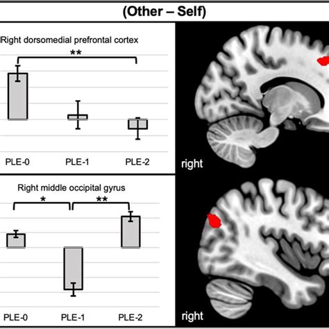 Between Group Differences In Activation Levels During The Otherself