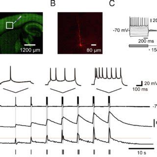 Simultaneous Calcium Imaging And Electrophysiology In A Mouse Motor