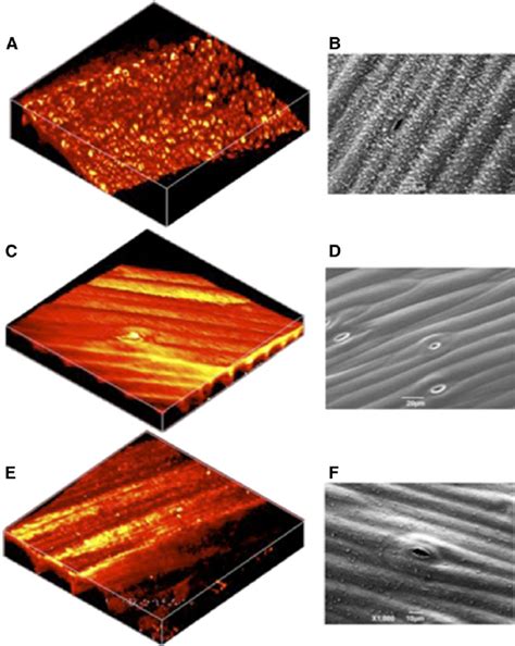 SRS images and scanning electron mi- crographs of Arabidopsis cuticle ... 