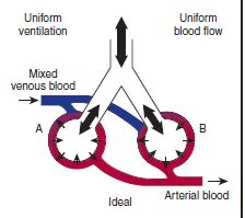 Ventilation Perfusion Respiration Flashcards Quizlet