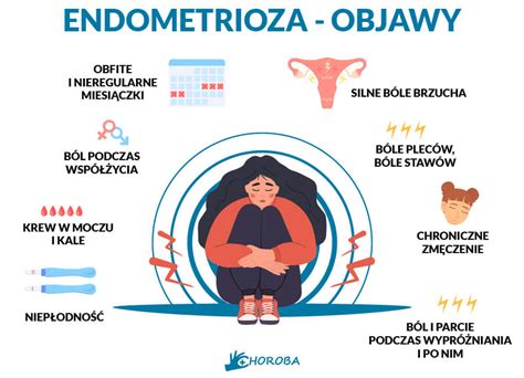 Endometrioza Czym Jest Przyczyny Objawy Sposoby Leczenia Sexiz Pix