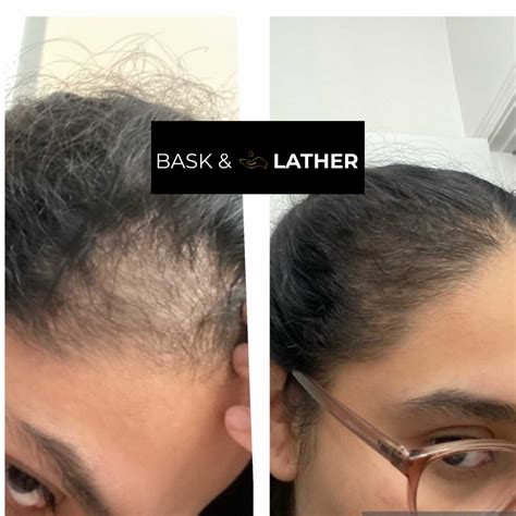 Rosemary Oil For Hair Growth Before And After Bask And Lather Co