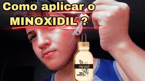 Minoxidil Como Usar Minoxidil Youtube