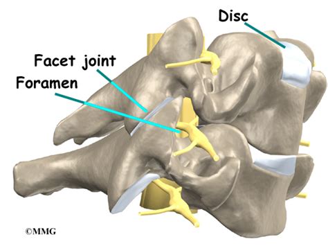 Cervical Foraminotomy Houston Methodist