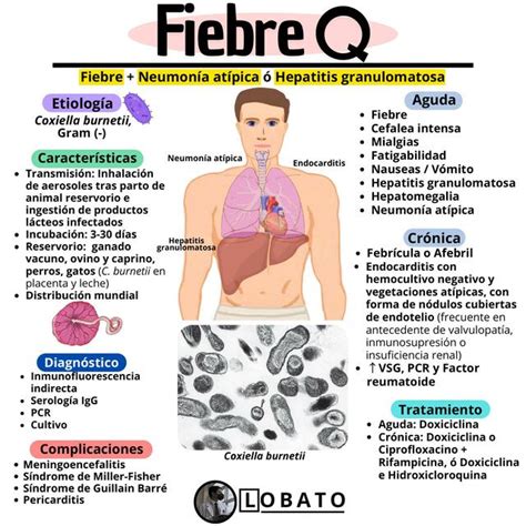 Fiebre Q Clínica Diagnóstico Tratamiento Complicaciones Lobato