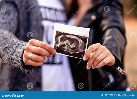 Couple Holding And Looking At Ultrasound Scan Of Their Baby Stock Image