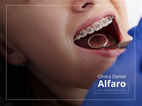 Ortodoncia Infantil Cl Nica Dental Alfaro