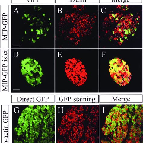 β Actin GFP bone marrow cells were injected into wild type mouse with