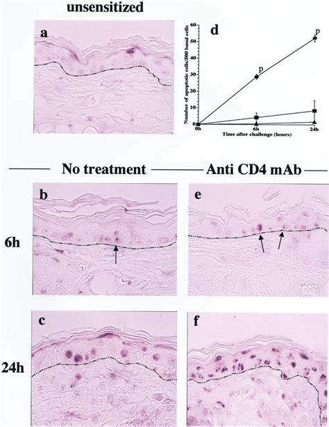 Immunohistochemical Analysis Of Apoptosis In The Skin During Chs