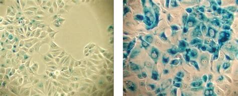 细胞衰老和老化概述 Cell Signaling Technology