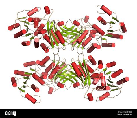 Glucose 6 Phosphatase Deficiency Doll Face
