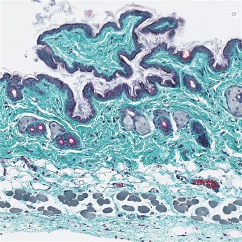 Masson S Trichrome Staining On Mouse Skin Masson Skin City Photo