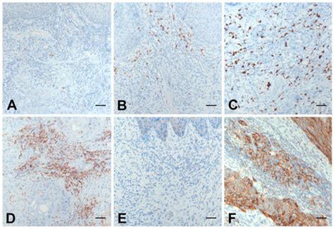 Applied Sciences Free Full Text Immunohistochemical Differences In