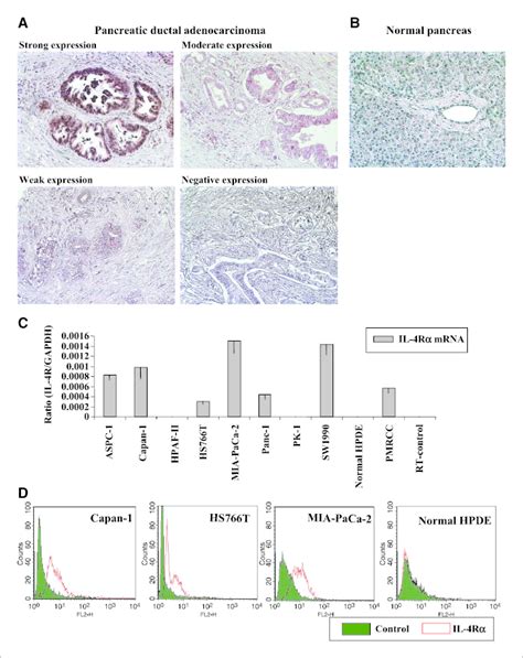 In Situ Expression Of Il R In Normal Pancreas And Pda Sections Mrna