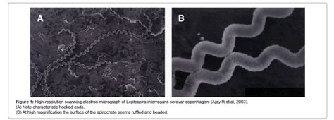 Leptospira Morphology Classification And Pathogenesis