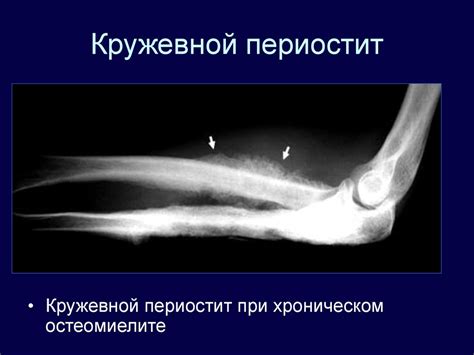 Лучевая диагностика заболеваний и повреждений опорно-двигательного ...