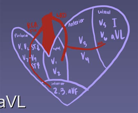 EKGs Flashcards Quizlet