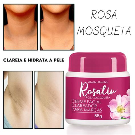 Creme Facial Clareador Para Marcas Extrato Rosa Mosqueta Hidrata E