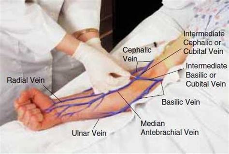 Venipuncture Sites Diagram