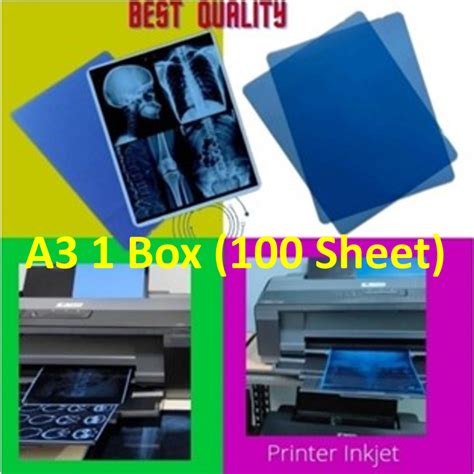 Jual Medical Dry Film Radiology Rontgen X Ray Bluebase Inkjet Ukuran