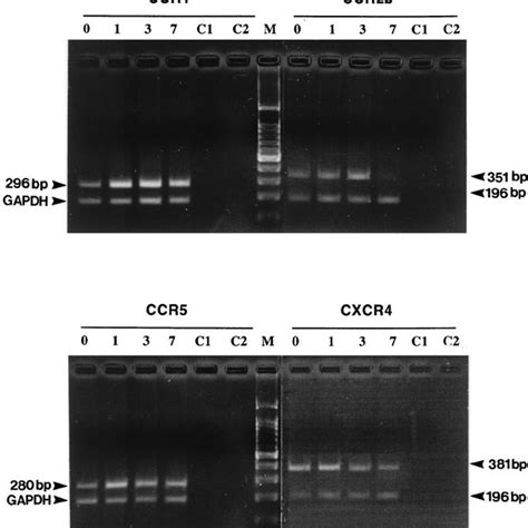 Expression Of The Chemokine Receptors Ccr1 Ccr2b Ccr3 Ccr5 And