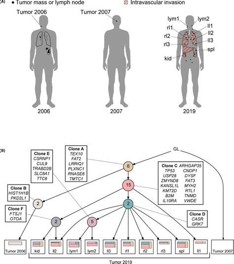 Phylogenetic Tree Indicating Tumor Evolution And Intratumor Download Scientific Diagram